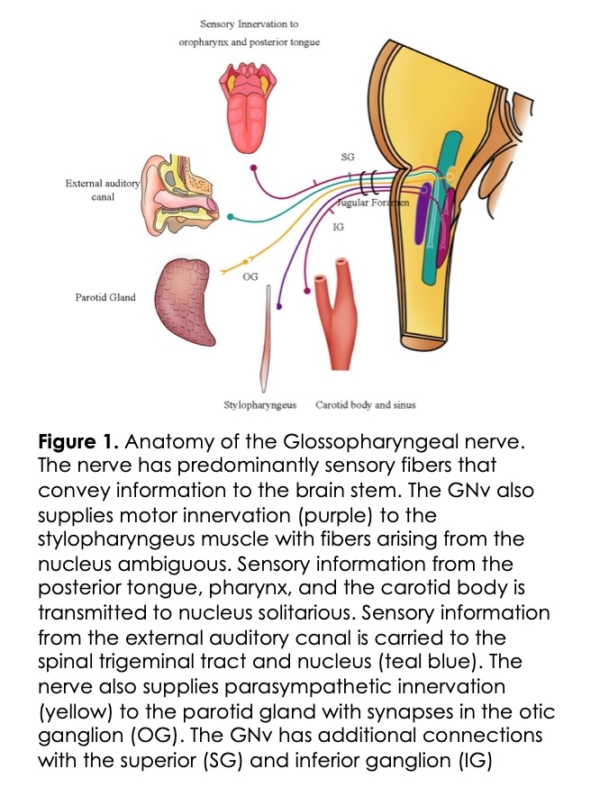 Glossopharyngeal Neuralgia An Approach to Diagnosis and Management