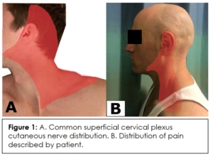 A Case of Successful Treatment of Iatrogenic Superficial Cervical ...